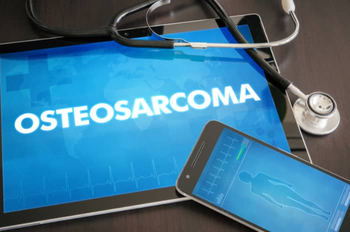 Osteosarcoma