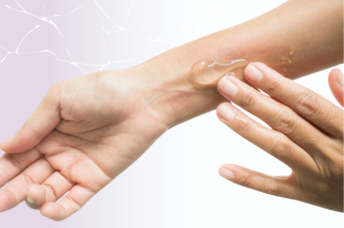 Sofargen® Repair: innovazione nel trattamento delle ferite acute e croniche